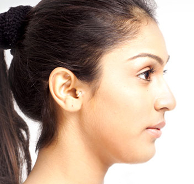 Best Skin Clinic in Coimbatore